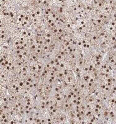 Immunohistochemistry-Paraffin: HIV-1 Tat specific factor 1 Antibody [NBP1-86966]