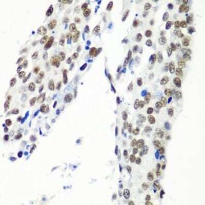 Immunohistochemistry-Paraffin: HIV-1 Tat specific factor 1 Antibody - BSA Free [NBP3-03409]