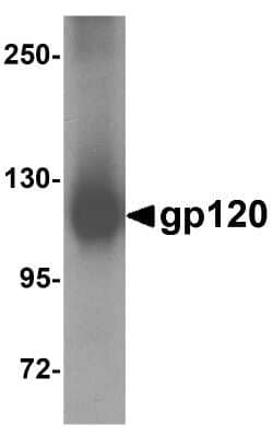 Western Blot: HIV-1 gp120 AntibodyBSA Free [NBP1-76371]