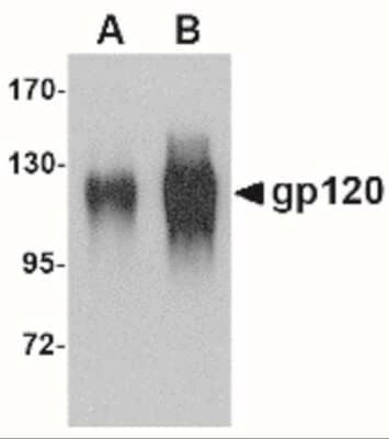 Western Blot: HIV-1 gp120 AntibodyBSA Free [NBP2-41090]