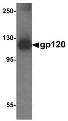 Western Blot: HIV-1 gp120 AntibodyBSA Free [NBP2-81822]