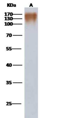 Western Blot: HIV-1 gp120 Antibody [NBP3-06424]