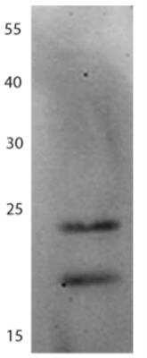 Western Blot: HIV-1 gp41 Antibody (425D11.01/ clone 3) [DDX1306]