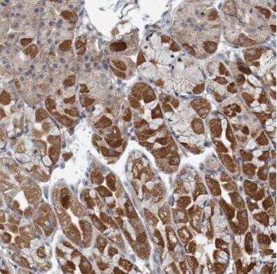 Immunohistochemistry-Paraffin: HIVEP1 Antibody [NBP2-30785]