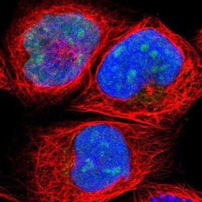 Immunocytochemistry/ Immunofluorescence: HJURP Antibody [NBP1-85025]