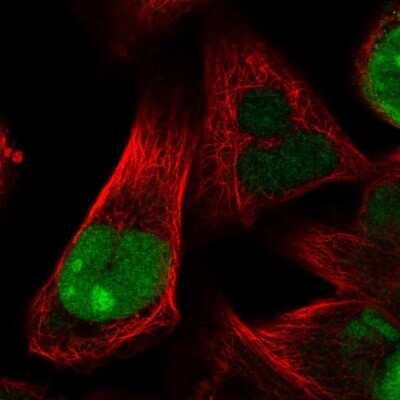 Immunocytochemistry/ Immunofluorescence: HJURP Antibody [NBP2-58281]