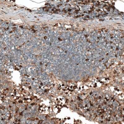 Immunohistochemistry-Paraffin: HJURP Antibody [NBP1-85025]