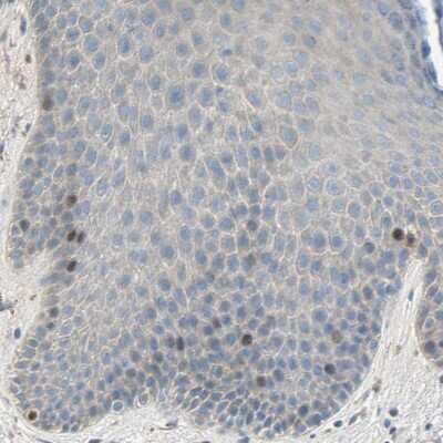 Immunohistochemistry-Paraffin: HJURP Antibody [NBP1-85025]