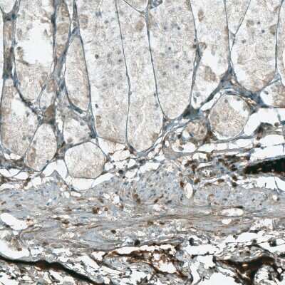 Immunohistochemistry-Paraffin: HJURP Antibody [NBP1-85025]