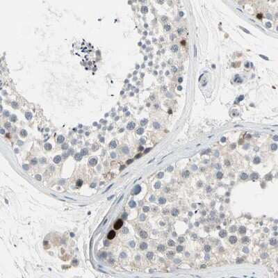 Immunohistochemistry-Paraffin: HJURP Antibody [NBP1-85025]