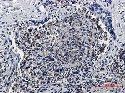 Immunohistochemistry-Paraffin: HJURP Antibody (S08-4B7) [NBP3-19874]