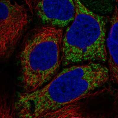 Immunocytochemistry/ Immunofluorescence: HKDC1 Antibody [NBP2-56396]