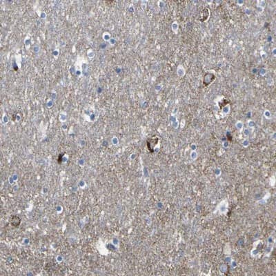 Immunohistochemistry-Paraffin: HKDC1 Antibody [NBP1-82108]