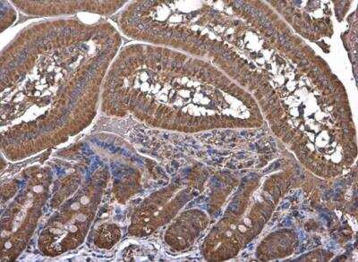 Immunohistochemistry-Paraffin: HKDC1 Antibody [NBP2-43539]