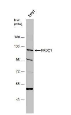 Western Blot: HKDC1 Antibody [NBP2-43539]