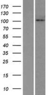 Western Blot: HKDC1 Overexpression Lysate [NBP2-06239]