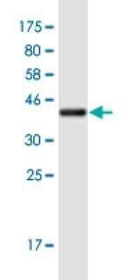 Western Blot: HKR1 Antibody (8E5) [H00284459-M06-100ug]