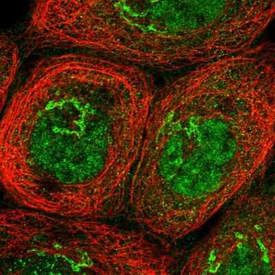 Immunocytochemistry/ Immunofluorescence: HKR1 Antibody [NBP1-86826]