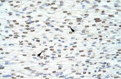 Immunohistochemistry: HKR1 Antibody [NBP2-87576]