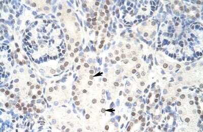 Immunohistochemistry: HKR1 Antibody [NBP2-87576]