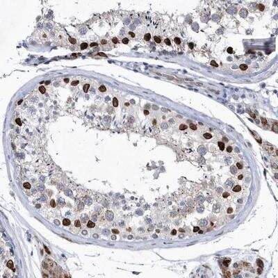 Immunohistochemistry-Paraffin: HKR1 Antibody [NBP1-86826]