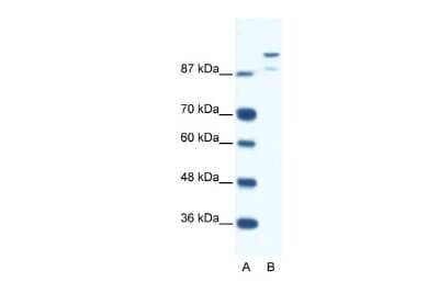 Western Blot: HKR1 Antibody [NBP2-87574]