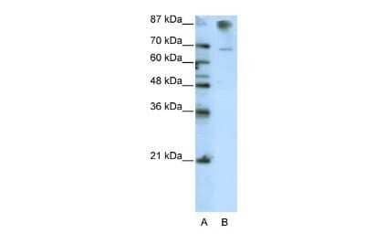 Western Blot: HKR1 Antibody [NBP2-87576]