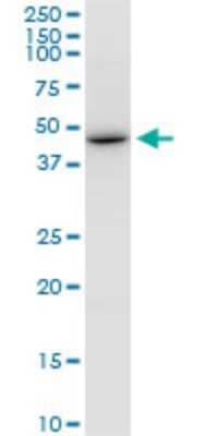 Western Blot: HKR2 Antibody (3E9) [H00342945-M08]