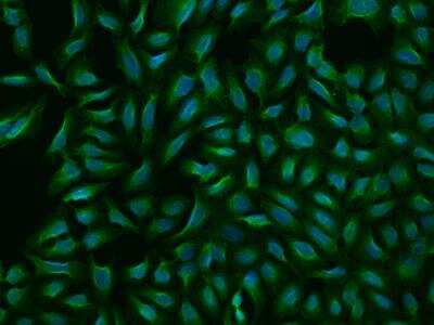 Immunocytochemistry/ Immunofluorescence: HKR2 Antibody [NBP3-06056]