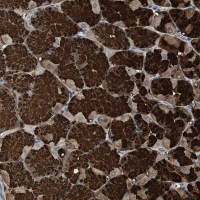 Immunohistochemistry-Paraffin: HKR2 Antibody [NBP1-91992]