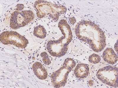 Immunohistochemistry-Paraffin: HKR2 Antibody [NBP3-06056]