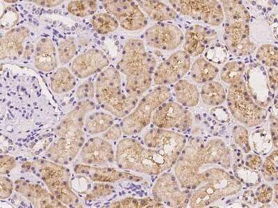 Immunohistochemistry-Paraffin: HKR2 Antibody [NBP3-06056]