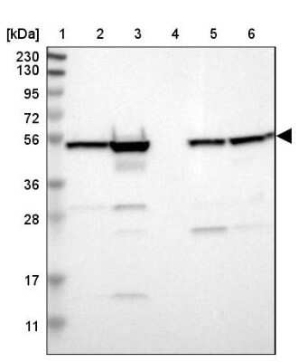 Western Blot: HKR2 Antibody [NBP1-91992]