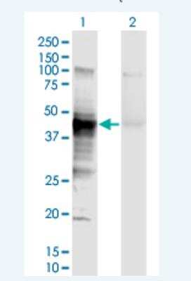 Western Blot: HLA A Antibody (2D6) [H00003105-M01-100ug]
