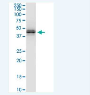 Western Blot: HLA A Antibody (2D6) [H00003105-M01-100ug]