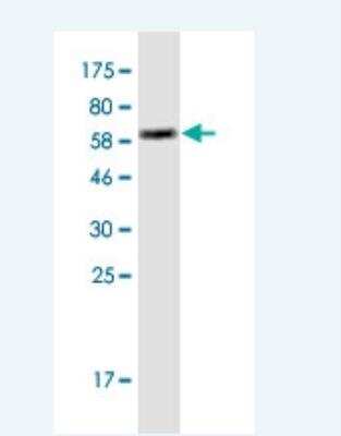 Western Blot: HLA A Antibody (2D6) [H00003105-M01-100ug]