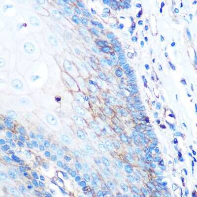 Immunohistochemistry-Paraffin: HLA A Antibody (8L2H2) [NBP3-15377]