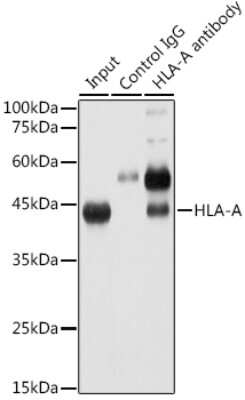 Immunoprecipitation: HLA A Antibody (8L2H2) [NBP3-15377]