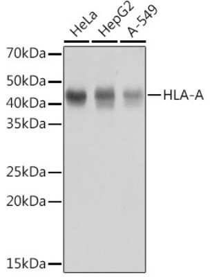 Western Blot: HLA A Antibody (8L2H2) [NBP3-15377]