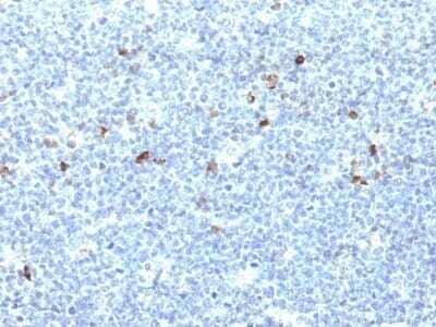 Immunohistochemistry-Paraffin: HLA A Antibody (CATA-1) - Azide and BSA Free [NBP2-47673]