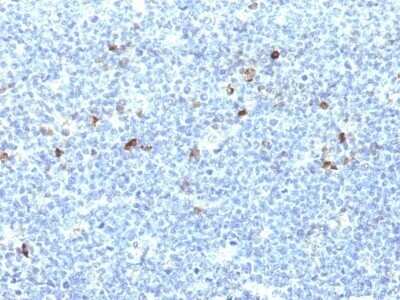 Immunohistochemistry-Paraffin: HLA A Antibody (CATA-1) - IHC-Prediluted [NBP2-48088]