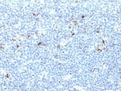 Immunohistochemistry-Paraffin: HLA A Antibody (CATA-1) [NBP2-45319]