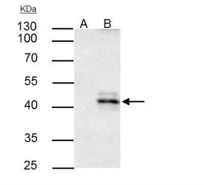 Immunoprecipitation: HLA A Antibody [NBP2-14982]