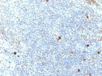 Immunohistochemistry-Paraffin: HLA A Antibody (SPM417) - IHC-Prediluted [NBP2-48098]