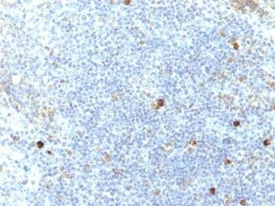 Immunohistochemistry-Paraffin: HLA A Antibody (SPM417) [NBP2-45317]