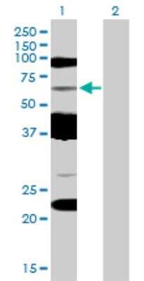 Western Blot: HLA A Antibody [H00003105-B01P]