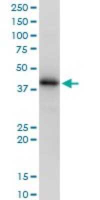 Western Blot: HLA A Antibody [H00003105-B01P]