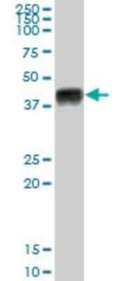 Western Blot: HLA A Antibody [H00003105-B01P]