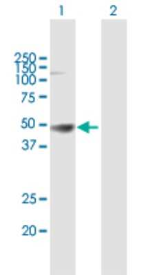 Western Blot: HLA A Antibody [H00003105-B01P]