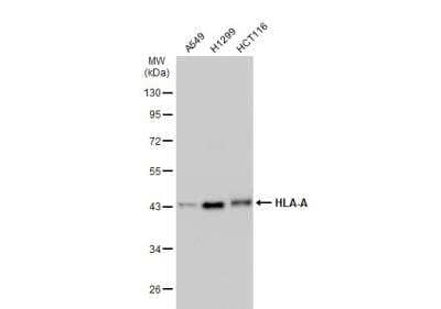 Western Blot: HLA A Antibody [NBP2-14982]